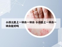 小孩儿脸上一块白一块白 小孩脸上一块白一块白能好吗