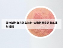 生物制剂自己怎么注射 生物制剂自己怎么注射视频