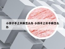 小孩子手上长癣怎么办 小孩手上长手癣怎么办