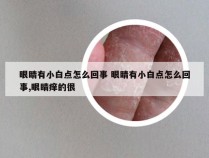 眼睛有小白点怎么回事 眼睛有小白点怎么回事,眼睛痒的很