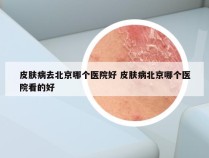 皮肤病去北京哪个医院好 皮肤病北京哪个医院看的好