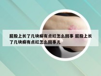 屁股上长了几块癣有点红怎么回事 屁股上长了几块癣有点红怎么回事儿