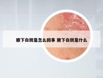 腋下白斑是怎么回事 腋下白斑是什么