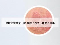 皮肤上变白了一块 皮肤上白了一块怎么回事