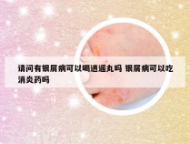 请问有银屑病可以喝逍遥丸吗 银屑病可以吃消炎药吗