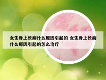 女生身上长癣什么原因引起的 女生身上长癣什么原因引起的怎么治疗