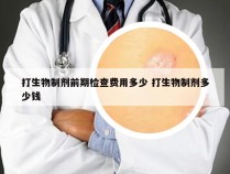 打生物制剂前期检查费用多少 打生物制剂多少钱