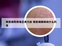 银屑病奇痒难忍用刀刮 银屑病瘙痒抹什么药膏