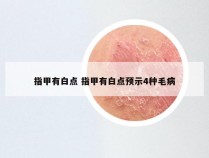 指甲有白点 指甲有白点预示4种毛病