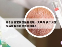 两个月宝宝突然后背出现一大块白 两个月宝宝后背有白斑是怎么回事?