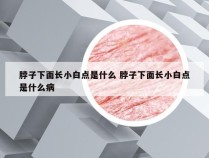 脖子下面长小白点是什么 脖子下面长小白点是什么病