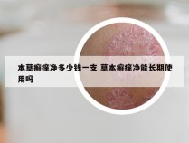 本草癣痒净多少钱一支 草本癣痒净能长期使用吗