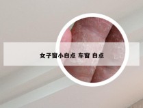 女子窗小白点 车窗 白点