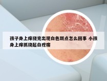 孩子身上痒挠完出现白色斑点怎么回事 小孩身上痒抓挠起白疙瘩