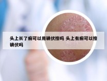 头上长了癣可以用碘伏擦吗 头上有癣可以擦碘伏吗