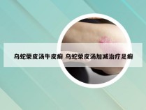 乌蛇荣皮汤牛皮癣 乌蛇荣皮汤加减治疗足癣