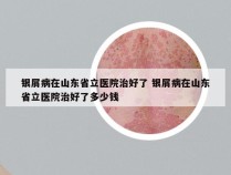 银屑病在山东省立医院治好了 银屑病在山东省立医院治好了多少钱