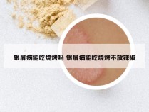 银屑病能吃烧烤吗 银屑病能吃烧烤不放辣椒