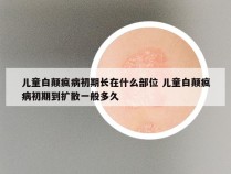 儿童白颠疯病初期长在什么部位 儿童白颠疯病初期到扩散一般多久