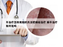 不治疗怎样用别的方法把癣给治疗 癣不治疗有坏处吗