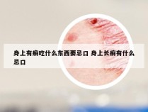 身上有癣吃什么东西要忌口 身上长癣有什么忌口