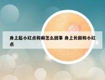 身上起小红点和癣怎么回事 身上长藓和小红点