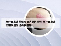 为什么点滴型银屑病消退的很慢 为什么点滴型银屑病消退的很慢呀