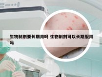 生物制剂要长期用吗 生物制剂可以长期服用吗