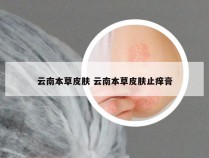 云南本草皮肤 云南本草皮肤止痒膏