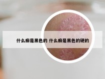 什么癣是黑色的 什么癣是黑色的硬的