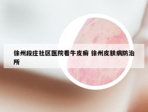 徐州段庄社区医院看牛皮癣 徐州皮肤病防治所