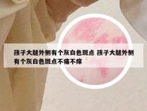 孩子大腿外侧有个灰白色斑点 孩子大腿外侧有个灰白色斑点不痛不痒