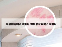 银屑病能喝八宝粥吗 银屑病可以喝八宝粥吗