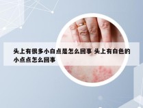 头上有很多小白点是怎么回事 头上有白色的小点点怎么回事