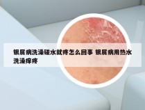 银屑病洗澡碰水就疼怎么回事 银屑病用热水洗澡痒疼