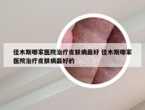 佳木斯哪家医院治疗皮肤病最好 佳木斯哪家医院治疗皮肤病最好的