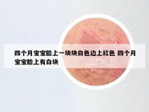 四个月宝宝脸上一块块白色边上红色 四个月宝宝脸上有白块