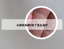 小孩长头癣5年了怎么治疗