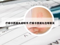 疗癣卡西甫丸说明书 疗癣卡西甫丸在哪里买