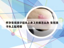 怀孕生完孩子后头上身上长癣怎么办 生完孩子头上起疙瘩