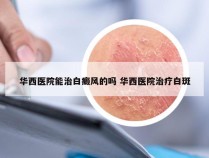 华西医院能治白癜风的吗 华西医院治疗白斑