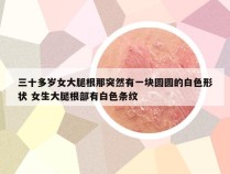 三十多岁女大腿根那突然有一块圆圆的白色形状 女生大腿根部有白色条纹