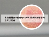 生物制剂哪个药店可以买啊 生物制剂哪个药店可以买啊