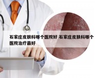 石家庄皮肤科哪个医院好 石家庄皮肤科哪个医院治疗最好