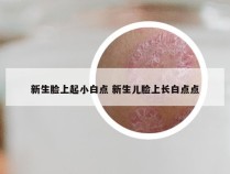 新生脸上起小白点 新生儿脸上长白点点