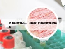 长春韶信白dian风医院 长春邵信皮肤医院