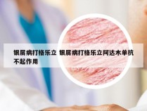 银屑病打格乐立 银屑病打格乐立阿达木单抗不起作用