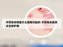 手臂有白斑是什么原因引起的 手臂有白色斑点怎样护理