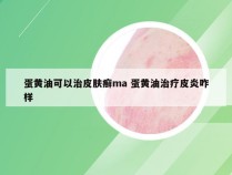 蛋黄油可以治皮肤癣ma 蛋黄油治疗皮炎咋样