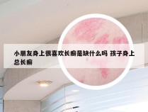 小朋友身上很喜欢长癣是缺什么吗 孩子身上总长癣